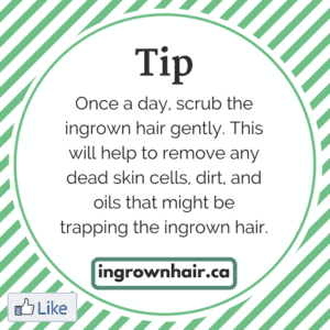 Check out our website, ingrownhair.ca for my tips on how to treat and prevent ingrown hairs. Learn how to get rid of scars from ingrown hairs.