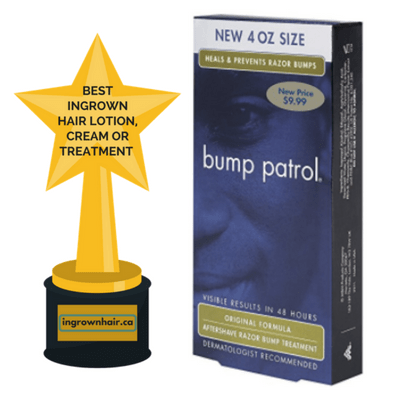 We love this cream and it is one of the best ingrown hair treatments
