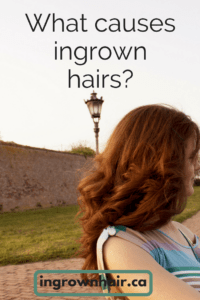 What causes ingrown hairs