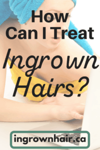 How can I treat ingrown hairs? It's easy. Follow a few simple steps from our website.