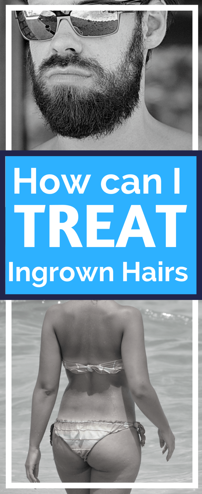 How can I treat ingrown hairs, razor burn and bikini bumps?