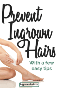 How to prevent ingrown hairs with a few easy tips