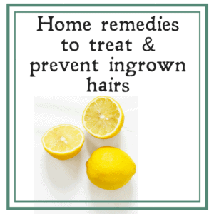 Common home remedies to treat ingrown hairs Common home remedies to treat ingrown hairs