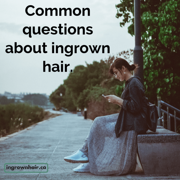 common questions about ingrown hairs
