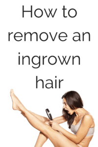 How to remove in an ingrown hair