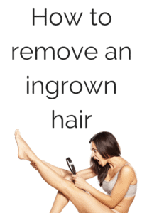 How to remove an ingrown hair