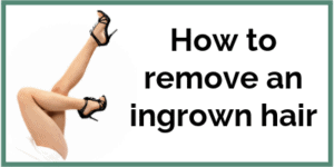 How to remove an ingrownhair