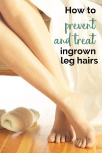 Learn how to treat and prevent ingrown leg hairs with a few easy steps. We have commercial and home remedies to help get rid of ingrown leg hairs today!