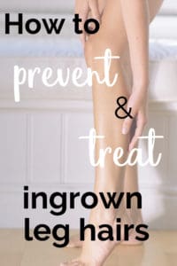 How to treat and prevent ingrown leg hairs