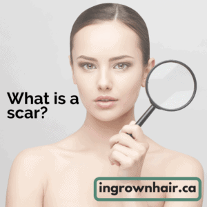 What is a scar?