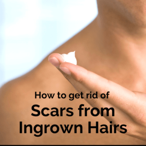 How to get rid of ingrown hair scars