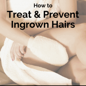 Treat and prevent ingrown leg hairs