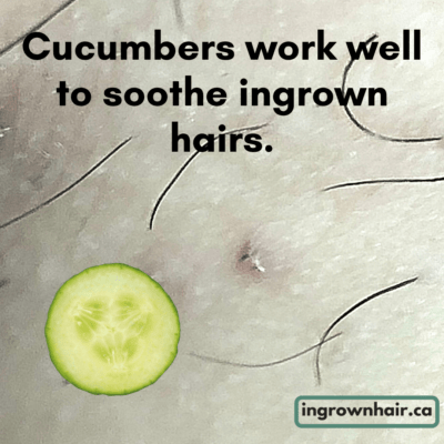 Cucumbers work well to soothe ingrown hairs